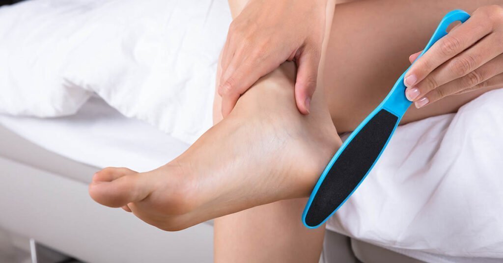 Eelt verwijderen met eeltvijl - stappen voor thuisbehandeling